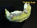 2 iced out teeth with bar