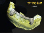 2 iced out teeth with bar