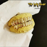 8 bottom 8 top diamond cut 14k gold Grillz