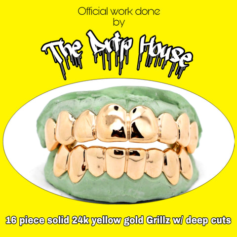 Custom 8x8 solid 24k yellow gold teeth with perm cuts